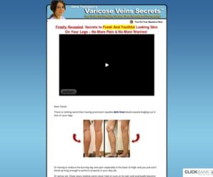 Get Rid Varicose Veins Naturally ** Hot Niche – 70%/sale