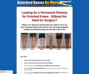 Knocked Knees No More – How to Straighten Your Legs Without Surgery!